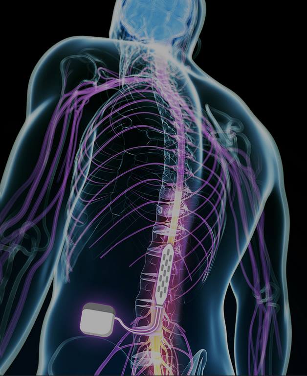 ESTIMULAÇAO IPIDURAL (1)